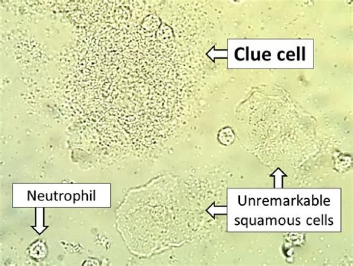 clue cells wet prep