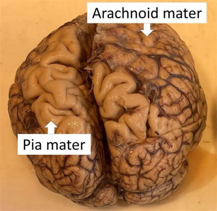 arachnoid mater